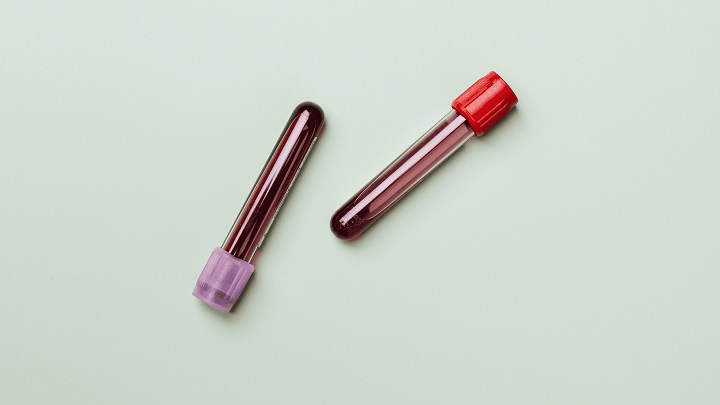 INR در آزمایش